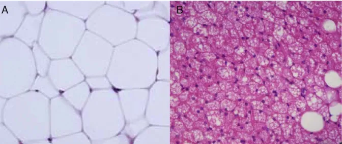 Figure 10 : Coupes histologiques et différences fonctionnelles entre le tissu adipeux blanc  et le tissu adipeux brun 