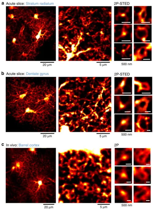 Fig. 1 Spongiform domain is formed by meshwork of nodes and shafts, and features loops