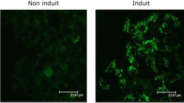 Figure  17  :  Détection  de  la  protéine  recombinante  ABCD2-EGFP  en  immunoblot,  avant  et  après  induction du clone 28.38 à la doxycycline (2µg/mL)