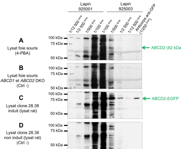 Figure  23 :  Réactivité  en  immunoblot  de  l’anticorps  polyclonal  anti-ABCD2  (sérums  des  lapins  N°925001 et 925003) à J70