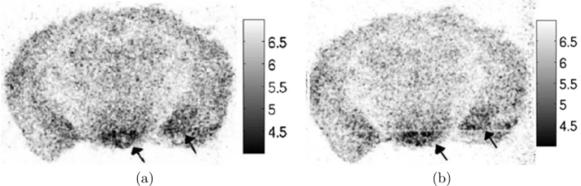 Figure 1.28 – Autoradiographie d’une coupe cérébrale de souris au niveau du caudate (Bregma 0,38 mm) avec le 35 SGTPγS après 16h d’exposition avec le capteur CCD (a) et le capteur CMOS (b) [Cabello 07a].