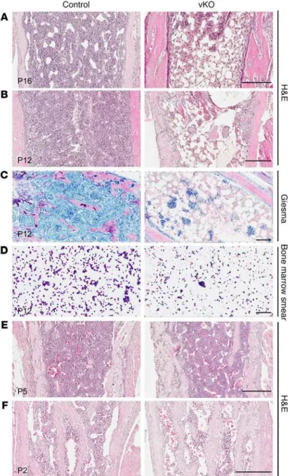 Figure 2. Brpf1 deletion leads to acute bone marrow failure. (A  and B) H &amp; E staining of long-bone sections from representative  control and Brpf1 fl/fl  Vav1-iCre (vKO) pups at P16 and P12