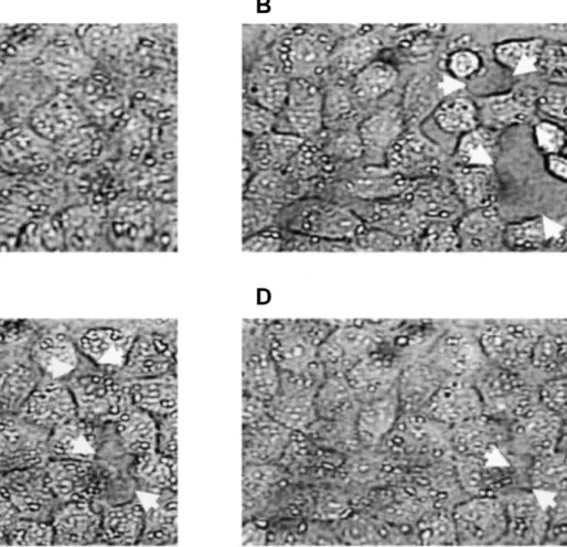 Figure  6  :  Sur  des  cultures  de  cellules  endothéliales  capillaires  pulmonaires  normales  (A)  l'application  de  100 U/ml de thrombine provoque une lésion inflammatoire qui entraîne, dès la 10 ème  minute, la formation de  larges interstices (flê