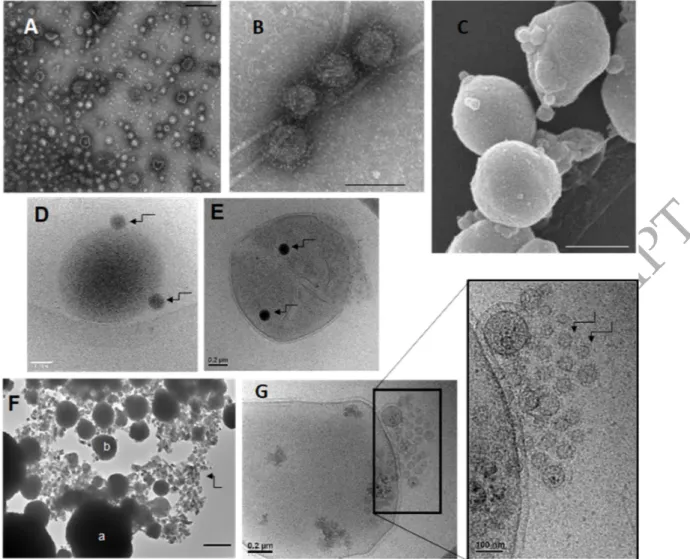 Figure  2:  Extracellular  vesicles  produced  by  Thermococcales.  Transmission  electron  microscopy  images  of  purified  EVs  produced  by  (A)  T