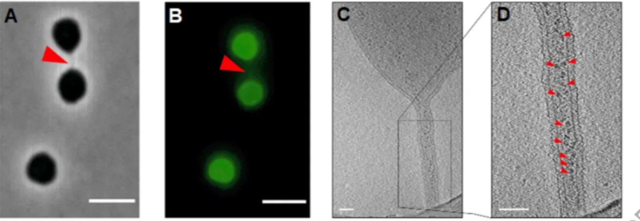 Figure 4: Nanotubes produced by Haloferax volcanii. Cells of Haloferax volcanii are linked  by nanotubes as observed by (A) phase-contrast and (B) fluorescence (B) microscopy
