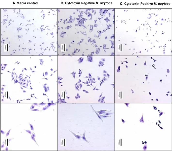Figure 2. Animal isolates of K. oxytoca produce cytotoxin. HEp-2 cell culture inoculated with K