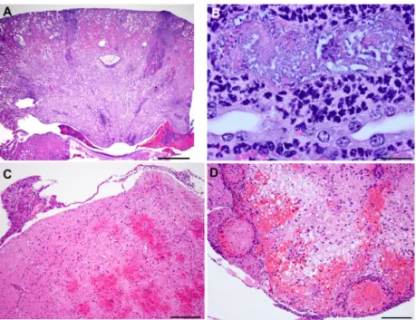 Fig 7. Histopathological lesions induced by pks+ E. coli (A) Moderate multifocal subacute suppurative pyelonephritis with tubular necrosis and intraluminal bacterial colonies