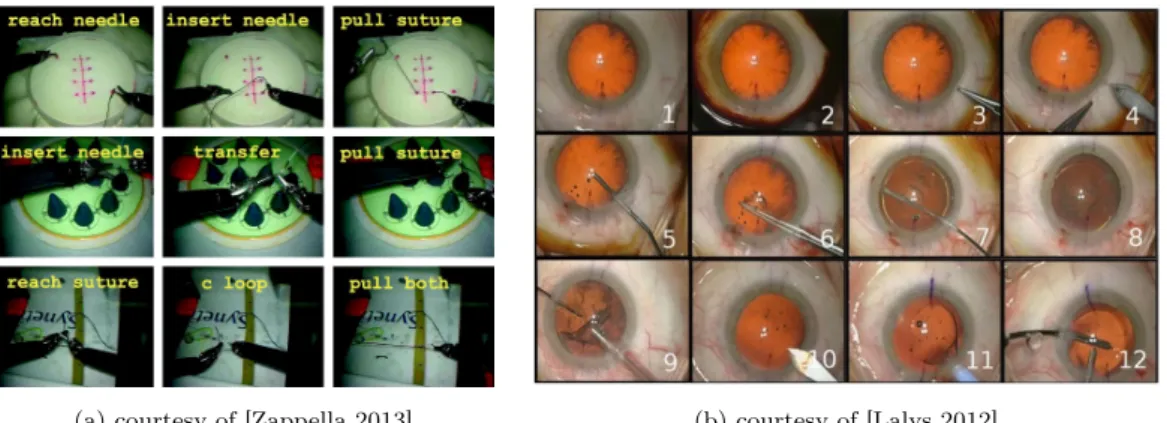 Figure 2.2: Image samples from tool-tissue interaction videos: (a) suturing pod recordings and (b) cataract procedures.