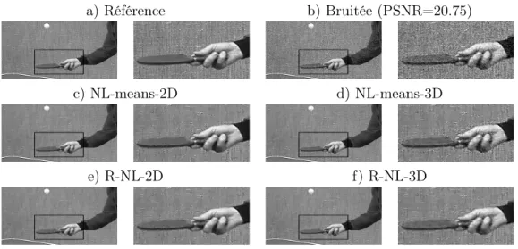 Figure 7 – Différence entre patchs 2D et patchs 3D. Extraits de séquences d’images débruitées par des méthodes à patchs 2D, à savoir NL-means-2D, R-NL-2D et  V-BM3D, et par des méthodes à patchs 3D, NL-means-3D,R-NL-3D et BM4D