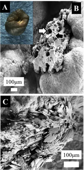 Fig. 4. Crystals present in urine as Janus particles. (A) Calcite crystals at the corners of a crystal made of COD (B) weddellite crystals deposited on the surface of anhydrous uric acid.