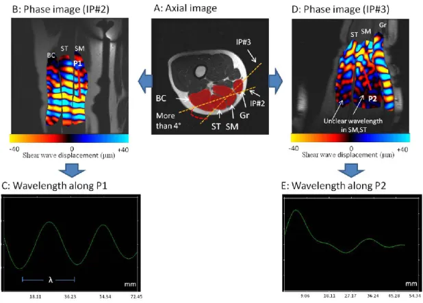 Figure 3.8 shows the values of the shear moduli for the nine muscles and the subcutaneous  adipose tissues