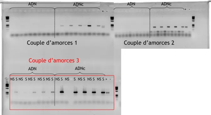 Figure II.5 : Test de trois couples d’amorces PCR sur des échantillons d’ADNc et d’ADN  génomique de femelles L