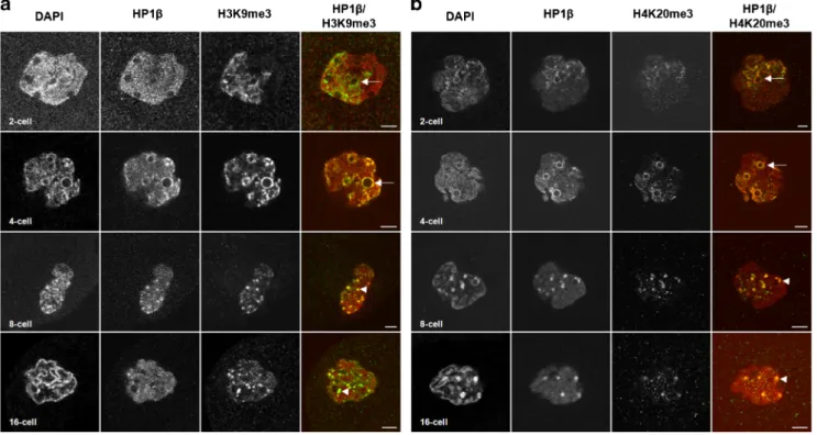 Fig. 5 Spatial localization of H3K9me3 and H4K20me3 during rabbit preimplantation development