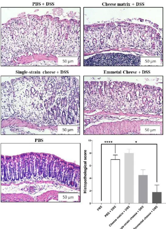 Figure  4.  Impact  of  cheese  matrix,  single-strain  cheese  and  Emmental  cheese  on  DSS-induced  histopathological  damages