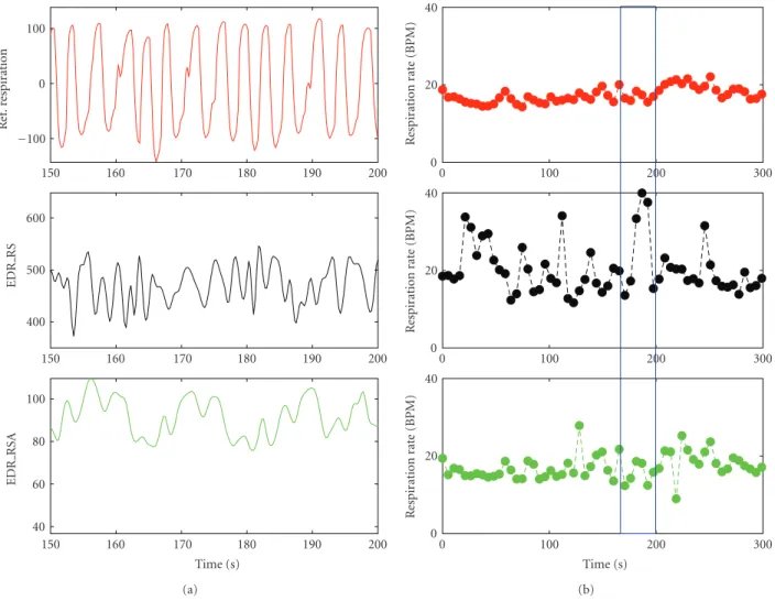 Figure 2: Respiratory rate estimation, from top to bottom: nasal thermistor (taken as the gold-standard), EDR RS (amplitude modulation- modulation-based method), and EDR RSA (respiratory sinus arrhythmia-modulation-based method)