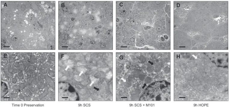 Fig. 2. TEM pictures of pig liver tissue. Data are presented before (A,E) and after 9 h preservation during SCS (B,F), SCS with M101 added to the UWCSS (SCS+M101) (C,G), and HOPE (D,H)