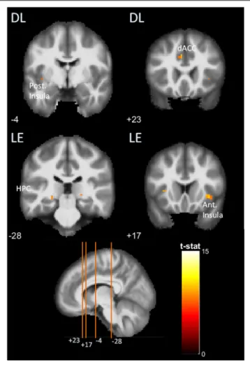 FIGURE 7 | Brain activations detected in functional MRI (fMRI) two-choice task viewed in coronal slices, in the posterior and anterior insula (Post