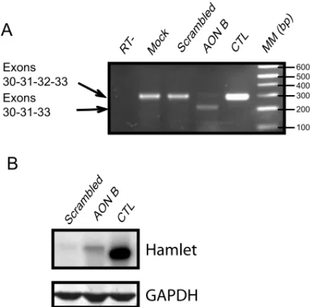 Fig. 1. AON B efficiently skipped dysferlin exon 32 in human patient cells. (A) Efficiency of exon skipping using AON B was assessed by RT-PCR on cells from patient 2