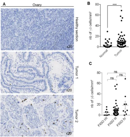 Figure 6. Detection of γδ T-cells in human ovarian samples. Immunohistochemical detection of γδ T- T-cells in 72 ovarian tumors and 49 paired normal ovarian samples