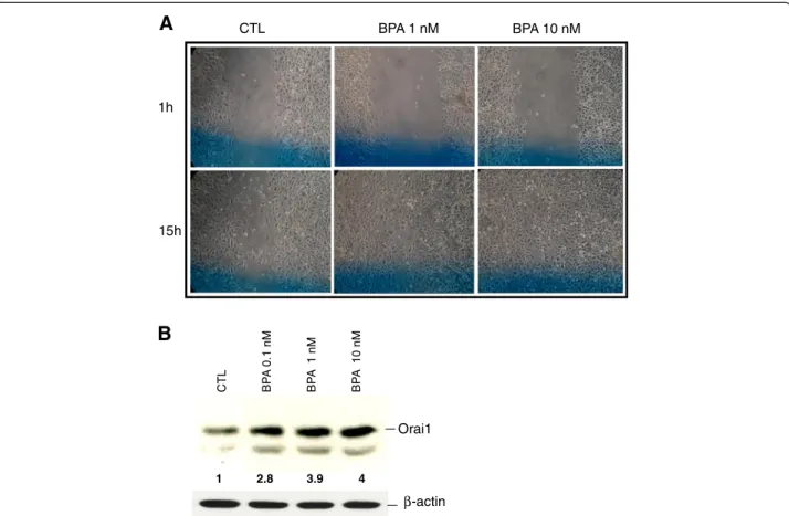 Figure 8 BPA induces the cell migration of androgen-independent prostate cancer cells