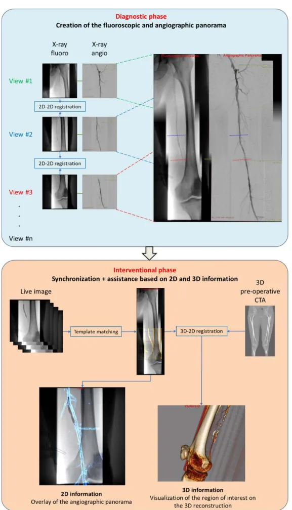 Fig. 1. Overall intra-interventional workflow of the image fusion system 