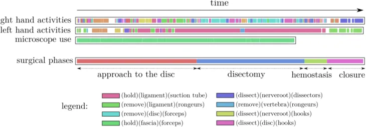 Fig. 1 Visualization of a surgery, each color corresponds to a different activity (see legend on the bottom)