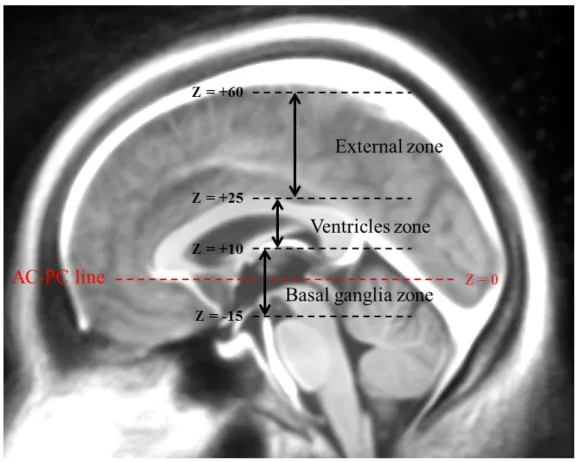 Figure 3. Subdivision of MRI in three zones according to AC-PC coordinates. 