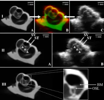 Fig. 5. Cochlea n°1: I. Merging of the two processed modalities: A. µCT slice after registration