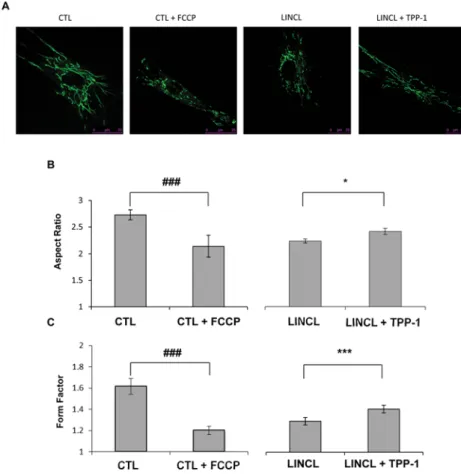 Figure 4 Effects of a TPP-1 deficiency on mitochondrial morphology