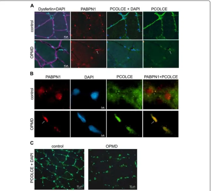 Figure 7 PCOLCE sub-cellular localisation in OPMD and control muscle biopsies. Muscle cryosections were co-stained for PABPN1 (red;