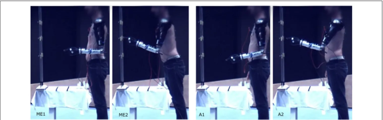 FIGURE 4 | Pointing movement toward target 5 at distance I performed with myoelectric control (ME1-ME2), and automatic control (A1-A2).