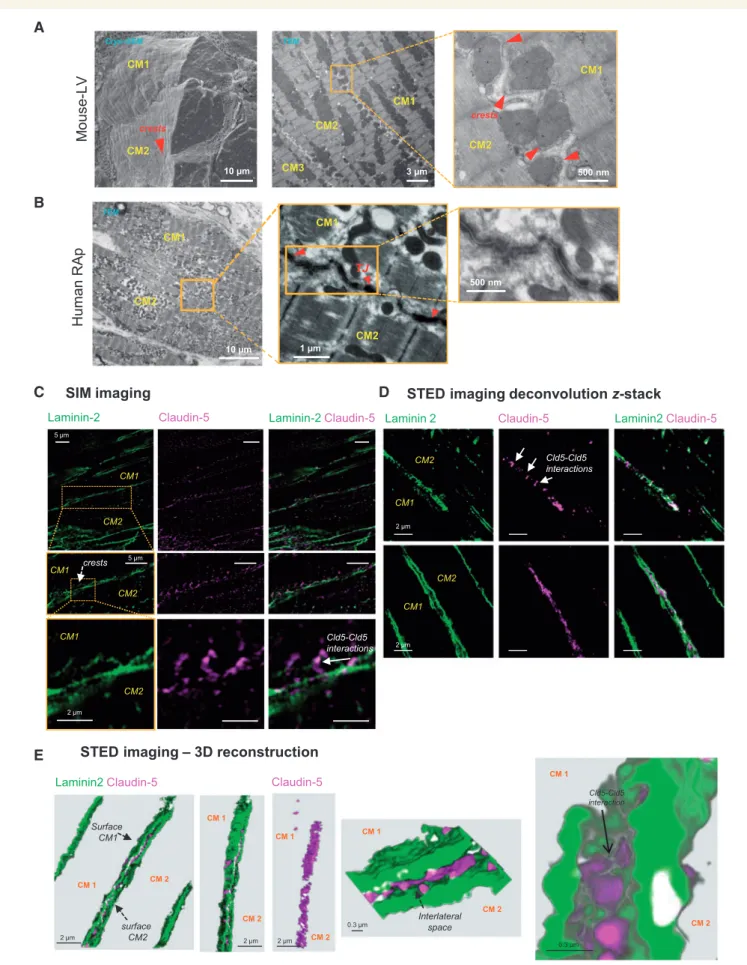 Figure 4 Neighbour CMs establish lateral physical contacts through tight junction-dependant crest–crest interactions