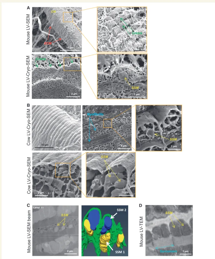 Figure 1 Lateral surface of adult cardiomyocytes (CM) exhibits crest architecture in left ventricular myocardial tissue