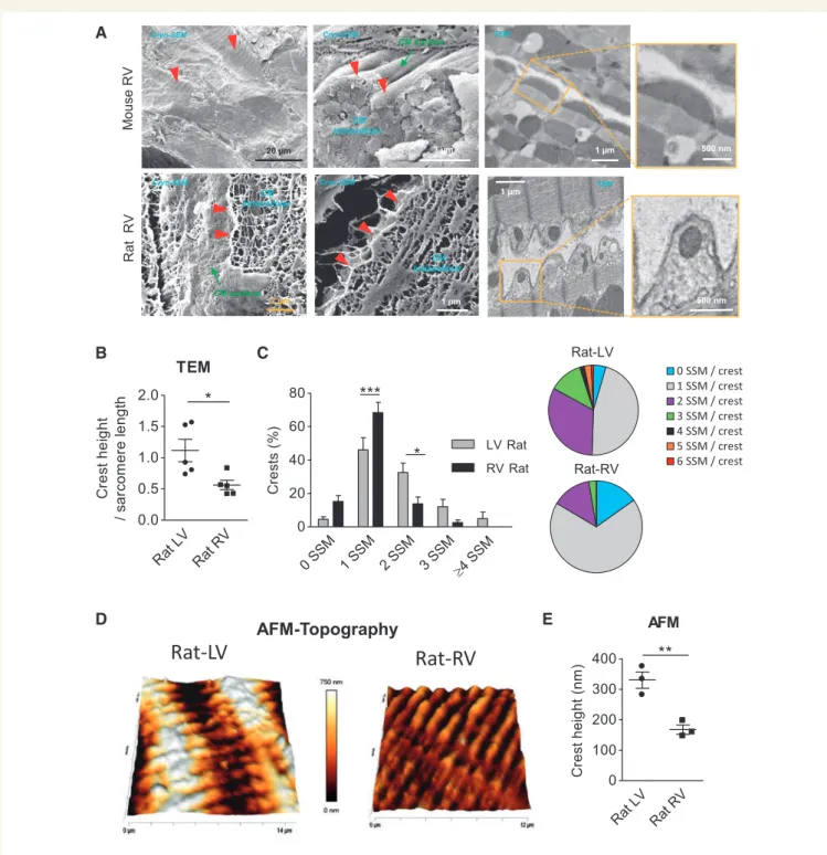 Figure 3 CM lateral surface crest relief differs in heart compartments. (A) Cryo-SEM or TEM micrographs showing CM surface crest relief of mouse (upper panels) or rat RV myocardium (lower panels)