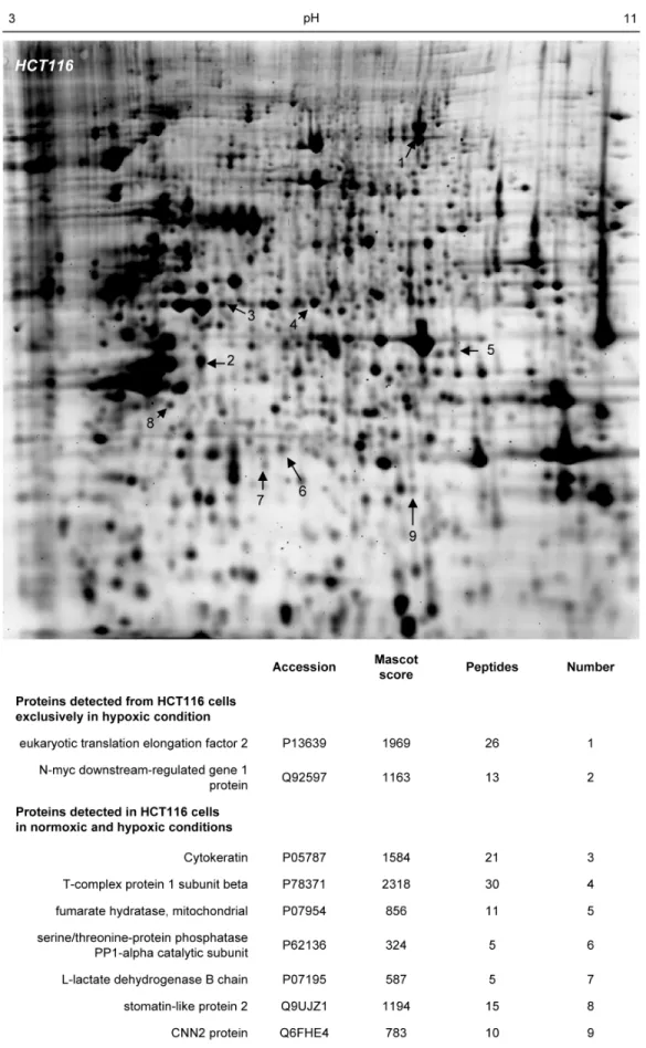 Figure 2. MS/MS-identification of proteins detected by SERPA from colorectal cancer cells exposed to hypoxia