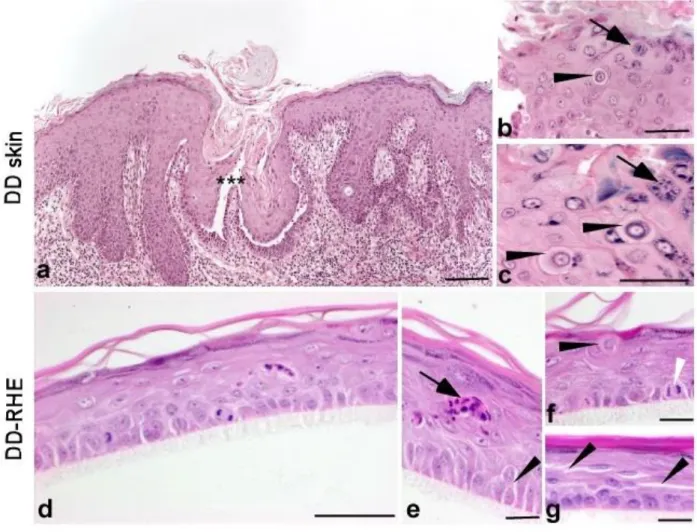 Figure 2.  Immunohistochemical staining for keratin 14, keratin 10 and involucrin shows  altered distribution in DD-RHE, reflecting a similar disease-linked differentiation defect both  in vitro and in vivo 