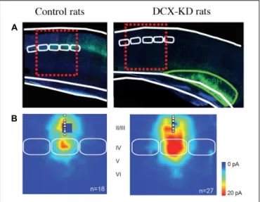 FIGURE 1 | Collateral Alterations of Functional Cortical Circuits in a Rat Model of Subcortical Band Heterotopia
