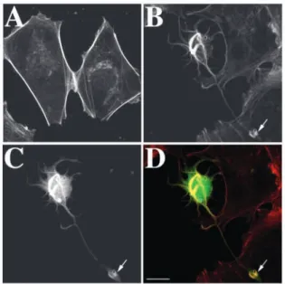 Fig. 3. Microtubule organisation in HEK 293 cells transfected with acidic calponin. Panels A and B illustrate the same control cells double stained with Texas Red-X phalloidin and  β -tubulin