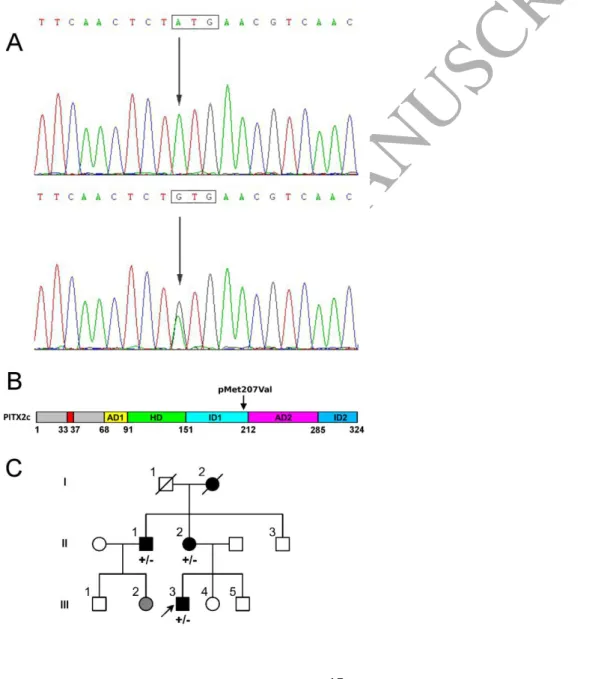 Figure 1.  Detection of the PITX2c variant, p.M207v, in patients with familial AF. A. The  sequence electropherogram of the patient carrying the heterozygous c.619A&gt;G variant