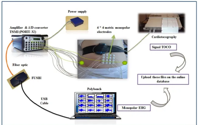 Figure 1.4: The new multichannel system: 4x4 electrode matrix placed on the women abdomen  with two reference electrodes on the hip and the tocographic probe