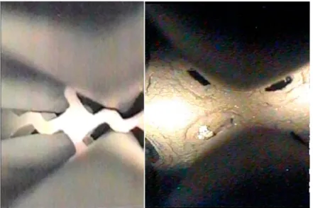 Figure 1.5: Example of picture taken from the top of the tubes. Left: no plugging deposit, right: