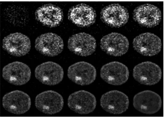 Figure 2.2 – Diff´erentes acquisitions temporelles d’une mˆeme coupe d’une image TEPd c´er´ebrale au [ 18 F]DPA-714