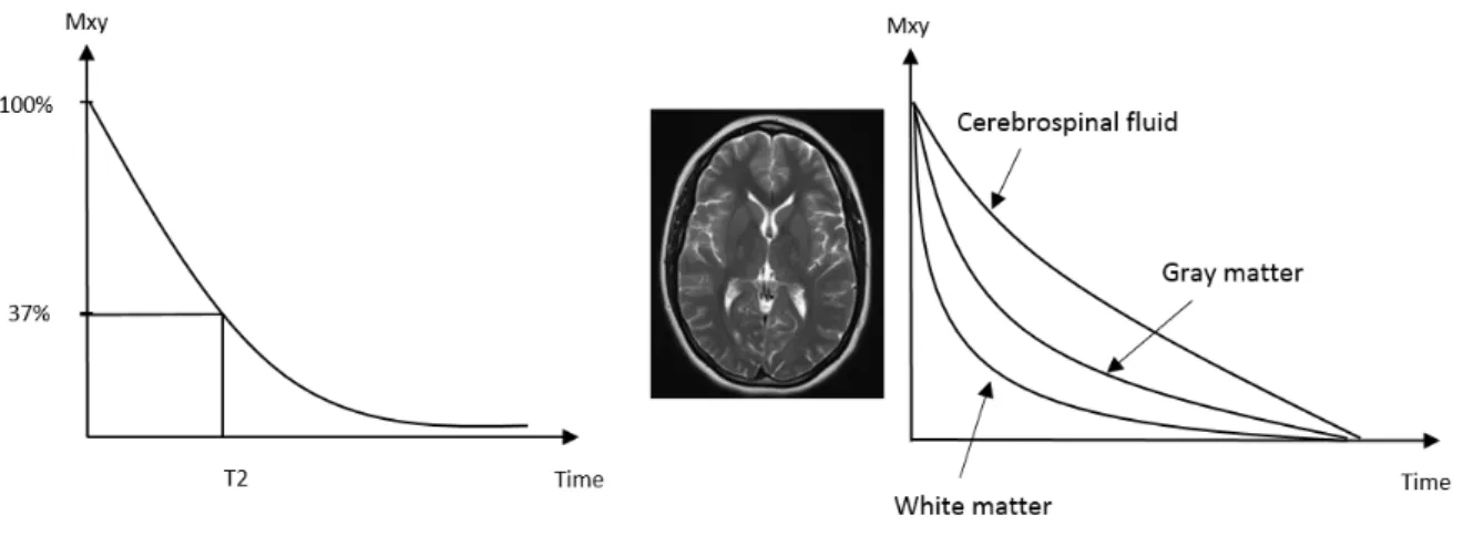 Figure  6.  Schema  of  the  spin  echo  sequence.  The  application  of  90°  radiofrequency  pulse  results in an immediate signal decay (free induction decay, FID)