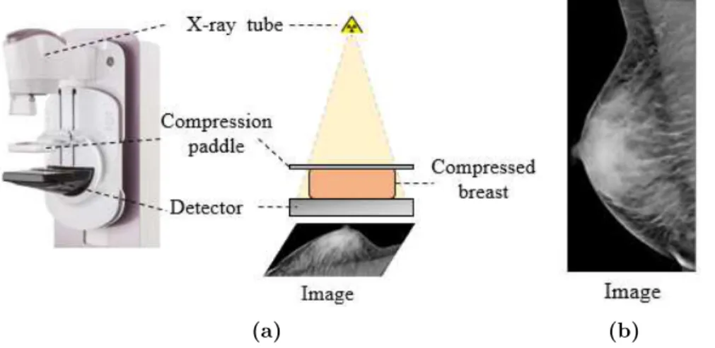 Figure 2.1: (a) A schematic of a mammography image acquisition. (b) Example of an acquired image from the imaging system.