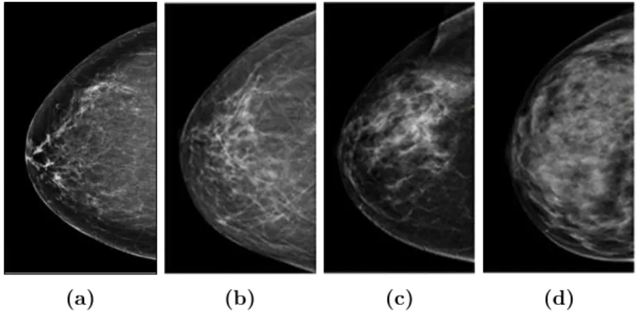 Figure 2.5: BI-RADS classification of breast density in mammography images : (a) almost entirely fatty