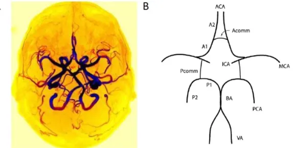 Figure  1.5.  (A)  Axial  maximum  intensity  projection  time-of-flight  (TOF)  images  of  a  complete  circle of Willis from one patient