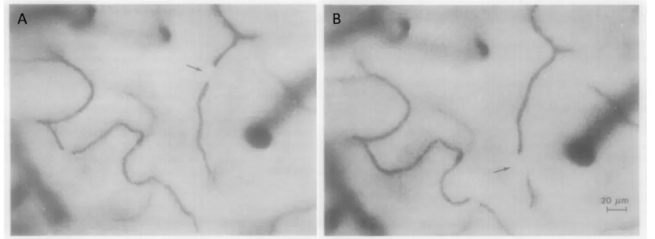Figure 1.14. Brain capillaries at depth 40 µm with arrows showing the  shift of the plasma gap