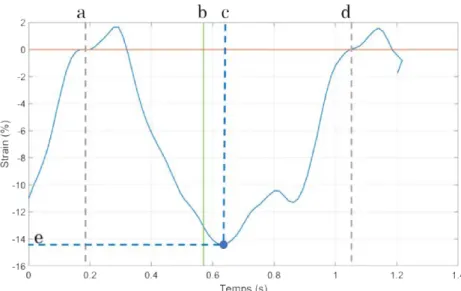 Figure 1.15 – Exemple du calcul des descripteurs échocardiographiques pour un segment à partir de sa courbe de strain.