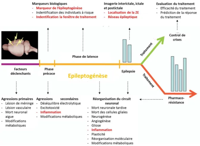 Figure I-2-8. Schéma des enjeux actuels dans la recherche préclinique en épilepsie adapté de  (Goffin et al