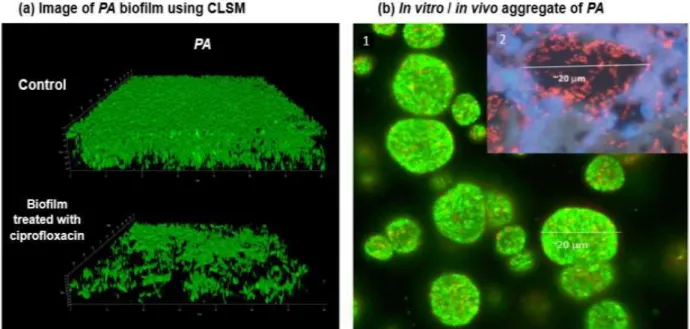 Figure  12.  Schematic  representation  of  microscopic  methods.  a)  Image  of  PA  biofilm  using  the  confocal  microscopy  (CLSM)
